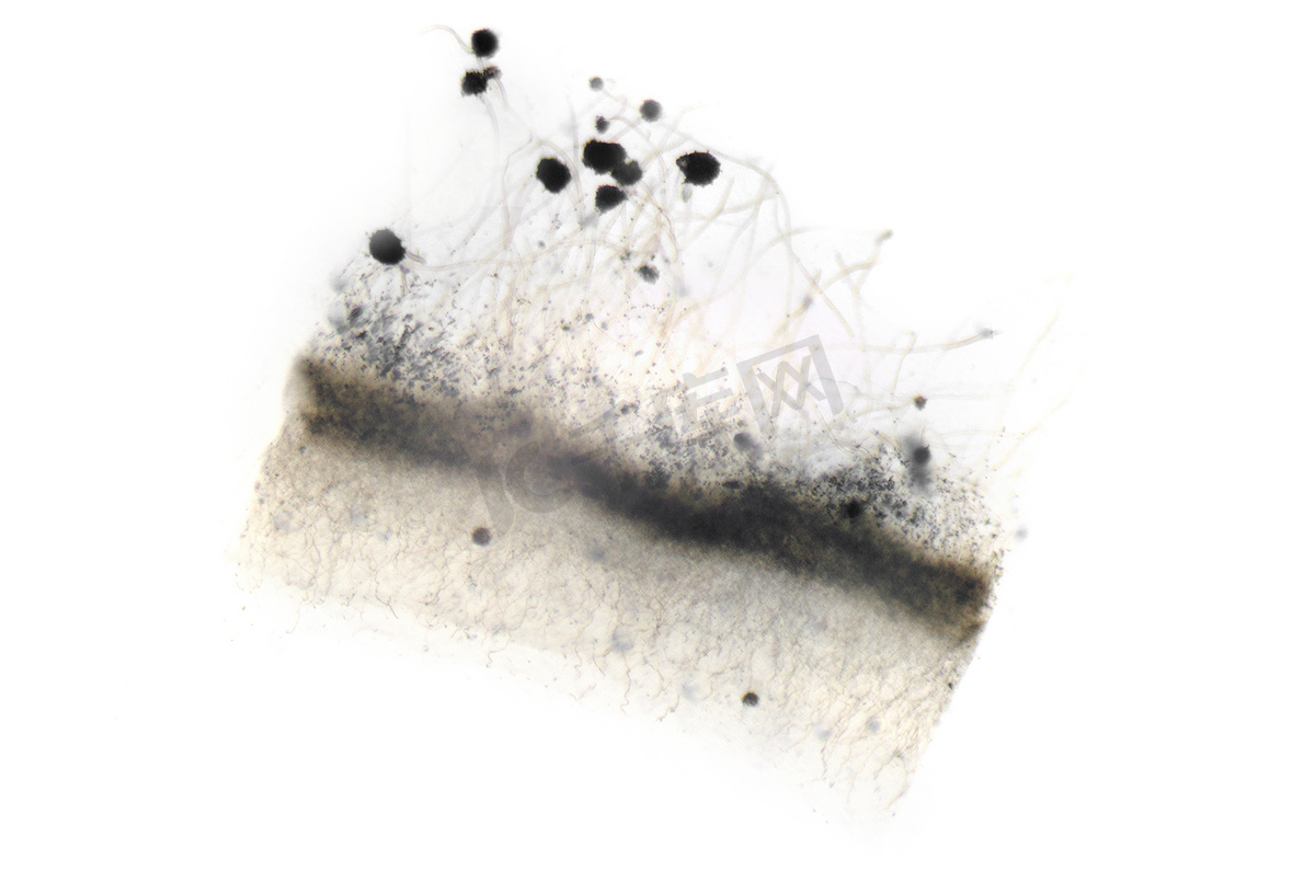 曲霉菌（霉菌）的显微镜照片图片