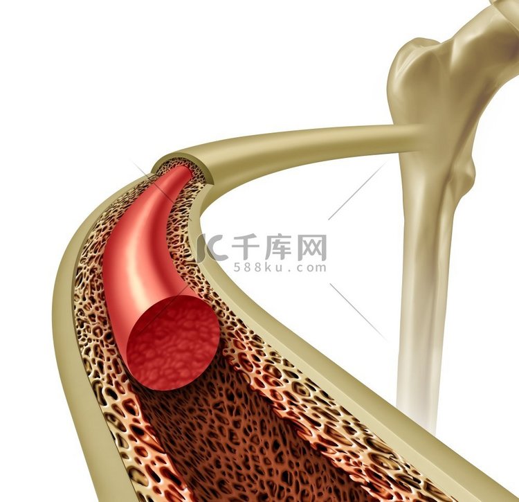 正常、医学、概念、整形外科