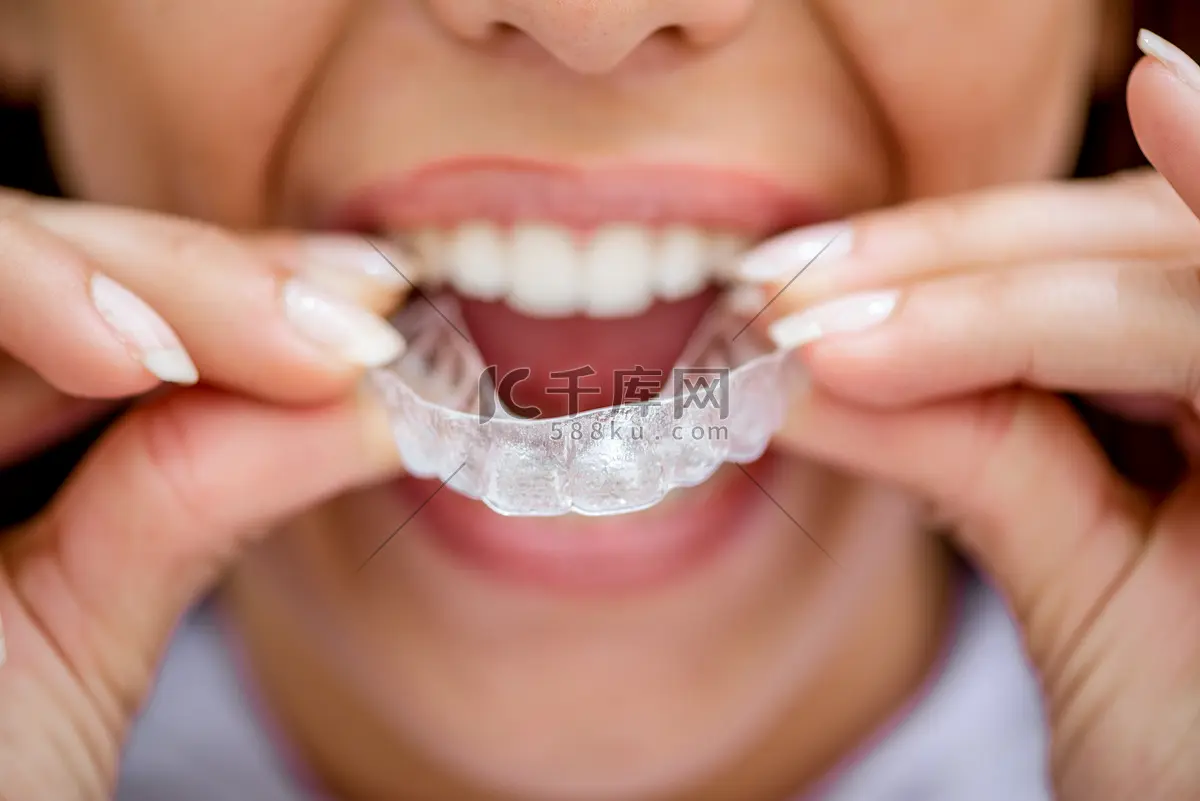 隐形牙套