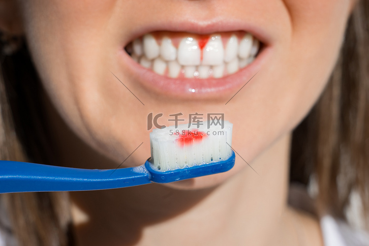 女人刷牙时牙龈出血。