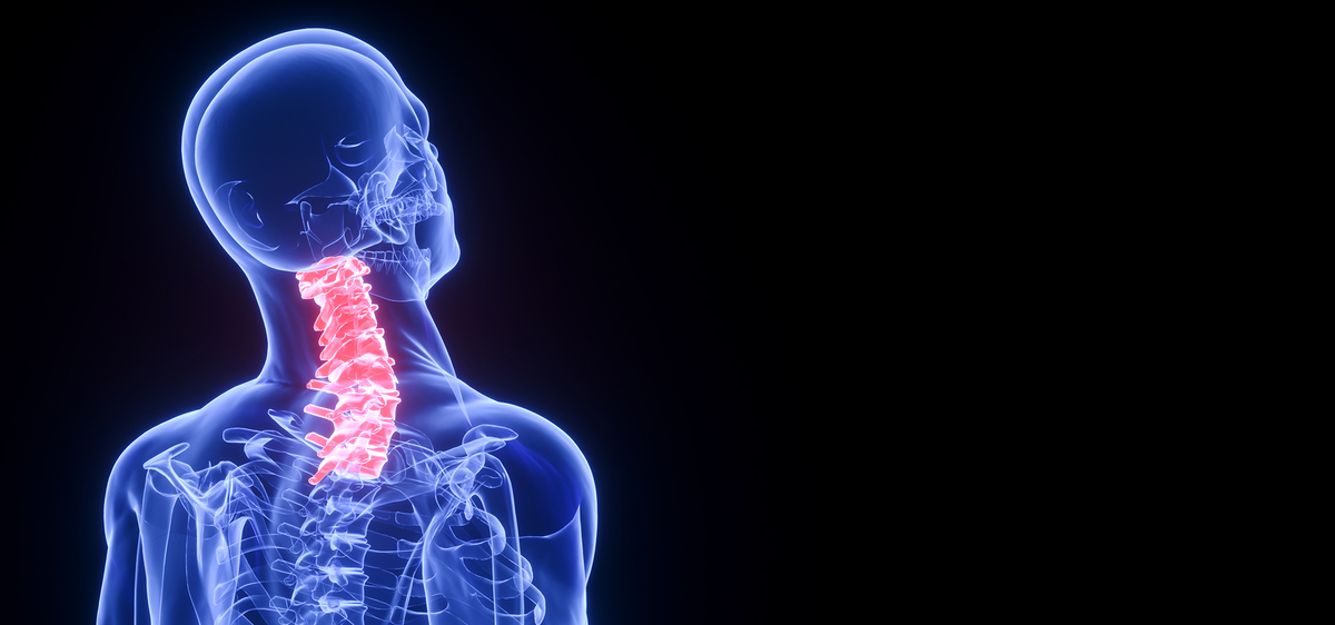 C4D创意医疗颈椎病人体骨骼背景图片