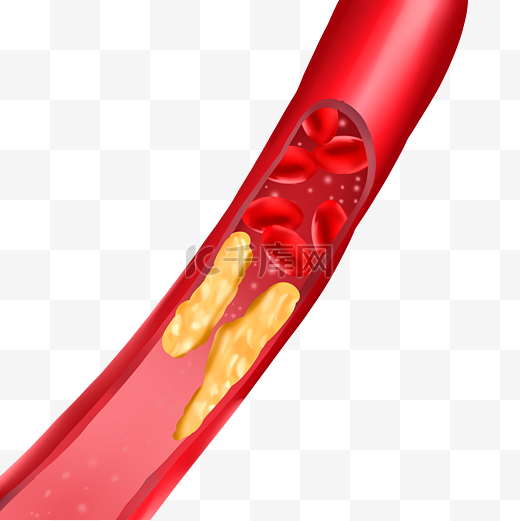 血栓血液血管图片