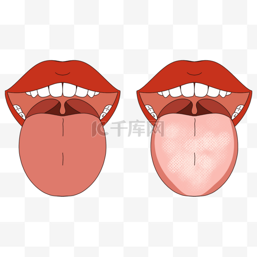 舌头口腔护理舌苔清洁对比图片