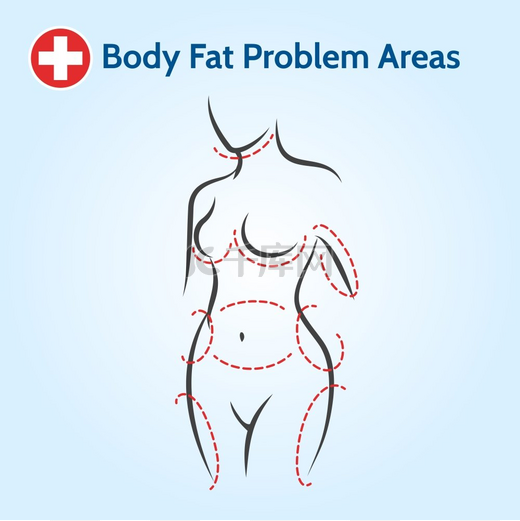 女性身体脂肪问题区域女性身体脂肪问题区域呈线条型矢量插图图片