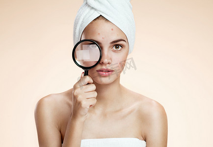 拿着放大镜脓包脸的女人。女人的皮肤护理概念