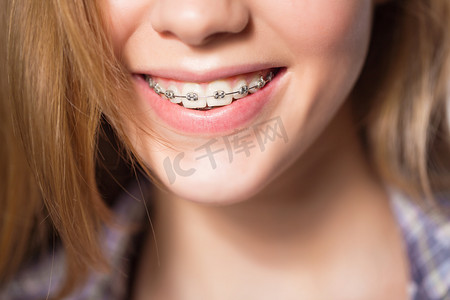 春风十里美丽如你摄影照片_十几岁的女孩显示牙齿矫正的肖像.