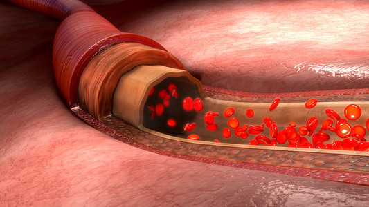 叠加流量包摄影照片_在人类血管中的血流量