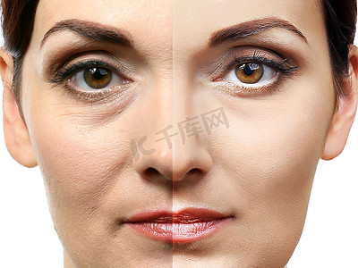 鼻子摄影照片_女人脸整容前后。整形外科概念.