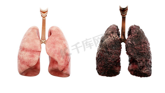 健康的肺和病肺白色隔离。尸体解剖医学概念。癌症和吸烟问题.