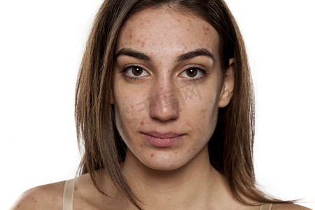三种肤色的人摄影照片_妇女与问题皮肤