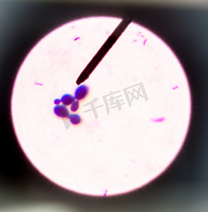 病原微生物摄影照片_芽殖酵母细胞.