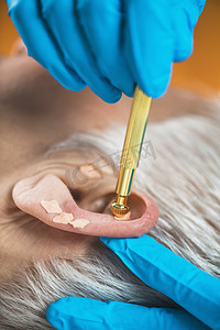 耳部治疗，或对人耳的眼膜治疗，特写。治疗师手应用针灸耳籽贴纸与钳子.
