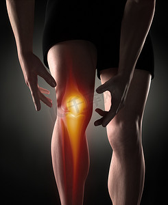 人膝关节疼痛概念