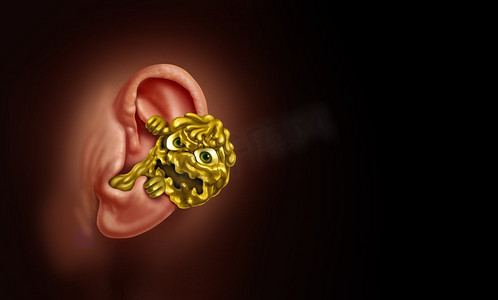 耳垢概念作为听力损失由于耳垢阻塞在内部解剖作为一个恶心的怪物蜡状物质与3D插图元素。