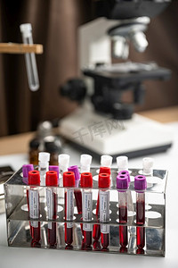 医学实验室里的一排人体血液样本，准备进行检测。医疗保健背景