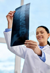 医学、保健和人民观念--在医院接受X光检查的快乐女医生。快乐的女医生在医院做X光检查