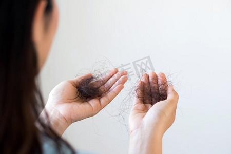 女性摄影照片_女性对洗发水过敏导致脱发