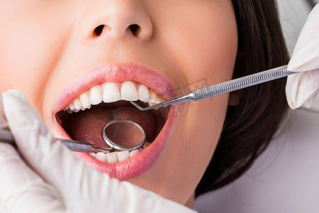 卫生巾主图摄影照片_在牙科医生口腔检查期间张开嘴的特写。在牙医那里做牙齿检查
