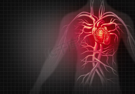 脑卒中摄影照片_心脏病发作和胸痛医学心血管疾病作为一种疾病的人体循环器官在3D插图风格。