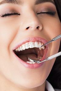 在考试的牙医病人一个相当愉快的牙医病人的特写镜头与她的嘴打开在考试