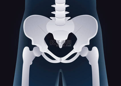 正常的人体骨盆骨在 x 射线概念的形状.