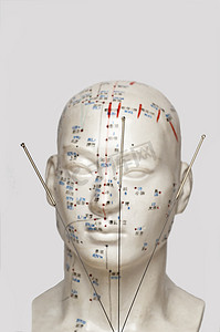 中医头疗摄影照片_在头模型的针灸针