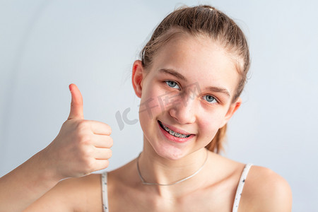 十几岁的女孩在牙齿矫正托槽中微笑，并竖起大拇指。