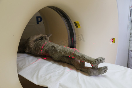 意大利 - 庞贝古城受害者 - CAT 扫描研究
