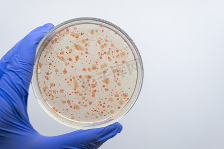 科学家的手拿着带有红色细菌菌落的培养皿。