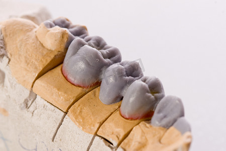 “人类的牙齿，模型”