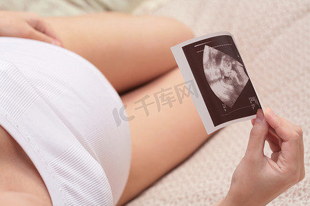 怀孕，胎儿的超声画像