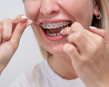 种牙摄影照片_白种女人用牙线清洁她戴着牙套的牙齿。