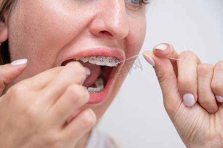 白种女人用牙线清洁她戴着牙套的牙齿。