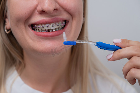 种牙摄影照片_白种女人用刷子清洁她戴着牙套的牙齿。