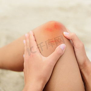 护理擦伤擦伤膝盖的女人