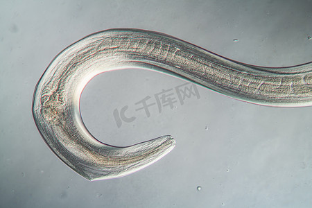 线下沙龙摄影照片_100x 显微镜下的线虫寄生虫