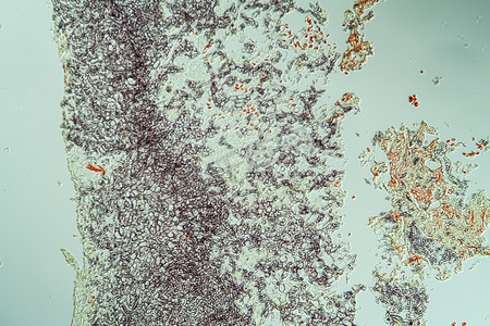 曲霉菌摄影照片_感染曲霉菌的患病耳组织 200x
