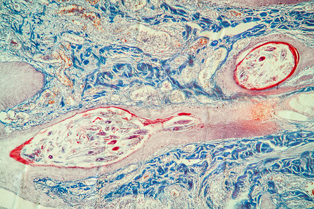 100x显微镜下的毛囊螨皮肤组织
