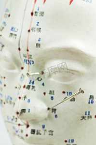 中医头疗摄影照片_在头模型的针灸针