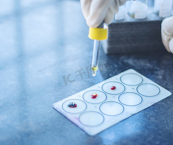 关闭，手测试血型称为 ABO 血型或测试协议，将抗血清添加到载玻片上的血滴中。
