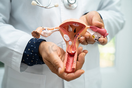子宫，医生持有解剖模型，用于医院研究诊断和治疗。