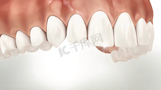 Invisalign 隐适美牙套或隐形保持器可以矫正咬合。