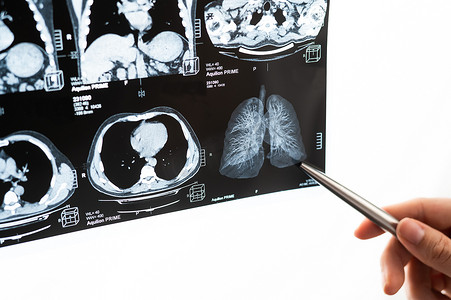 一位女医生检查内脏的核磁共振扫描。