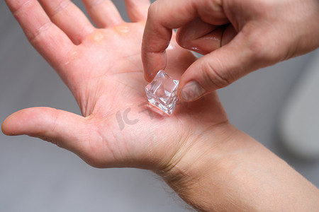 人们将一块冰放在手上以冷却皮肤