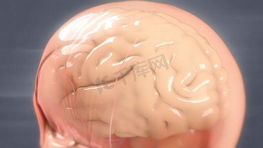 动脉瘤摄影照片_人脑解剖模型 3D