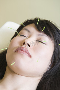 脸上有针灸针的亚洲女人闭着眼睛