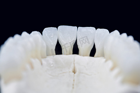 牙齿更健康摄影照片_人类下颌，牙齿在黑色背景下被隔离