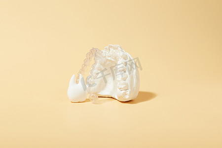 黄色背景中的正畸牙科主题。适用于正畸牙科治疗的透明隐形牙齿矫正器或牙套