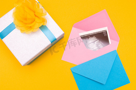 银盒中的超声图片，带蓝丝带和黄花黄色背景，复制顶视图，怀孕男孩或女孩的妇女，惊喜，照片作为礼物，怀孕概念