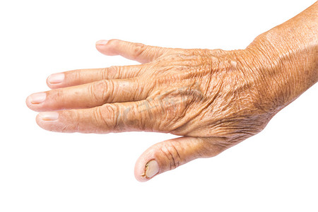 皮肤老化摄影照片_老妇人手部皮肤上有皱纹，有剪裁路径，健康而